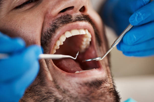 Best Dentist for Tooth Abscess  in Woodall, OK