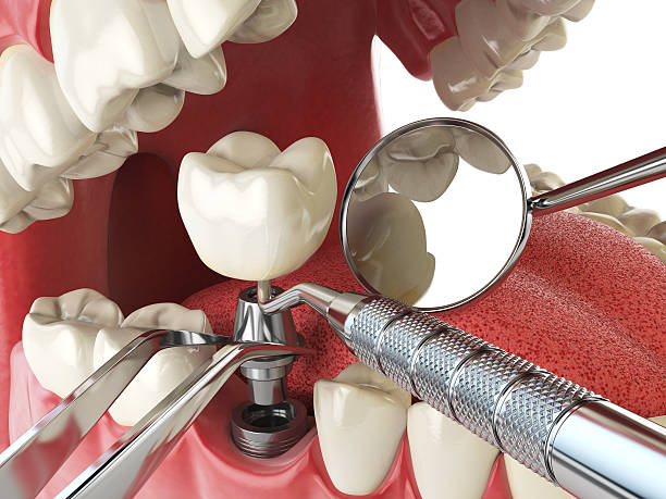 Best Cracked Tooth Emergency Dentist  in Woodall, OK