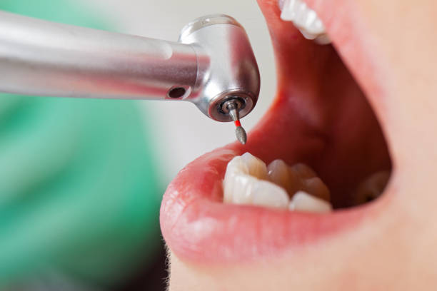 Best Teeth Whitening  in Woodall, OK